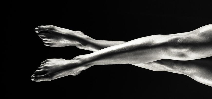 Dr Efraim vd Walt - Liposuction lower extremities Dr Efraim vd Walt - Liposuction lower extremities