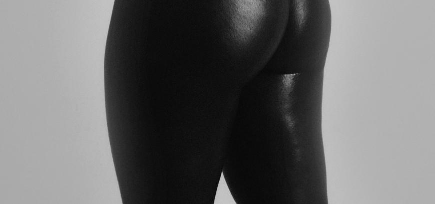 Dr Efraim vd Walt - Thigh Lift Dr Efraim vd Walt - Thigh Lift