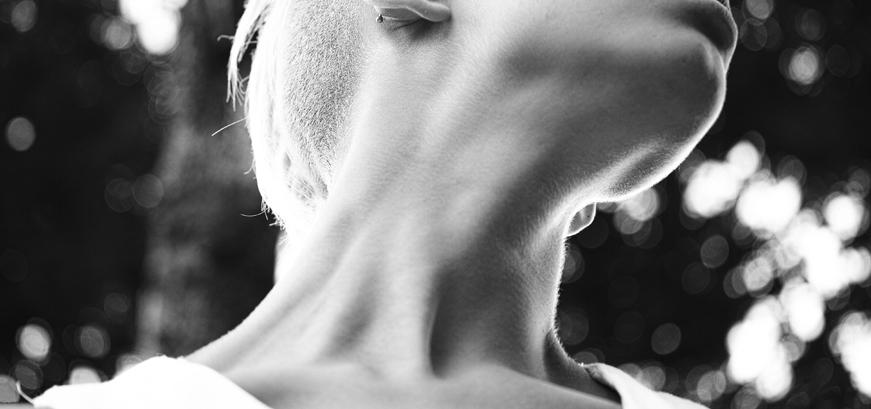 Dr Efraim vd Walt - Neck Lift Dr Efraim vd Walt - Neck Lift