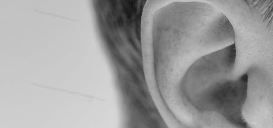 Dr Efraim vd Walt - Prominent Ears Dr Efraim vd Walt - Prominent Ears